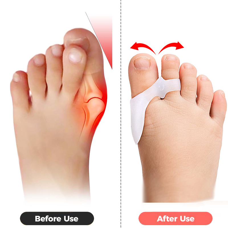 Pexmen 2/4Pcs Toe Spacers Buni - مراجعة Power Tools Kids وسعره